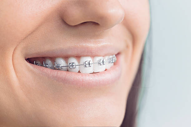 Full Mouth Reconstruction in Sayre, OK